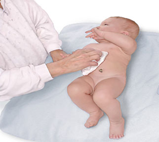 umbilical
